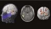  (Fuente imagen: Haarala C., Neuroreportlust-is-a-many-splendored-thing Apr-7-2008 )